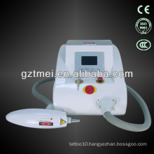 Laser Tatto Removal System